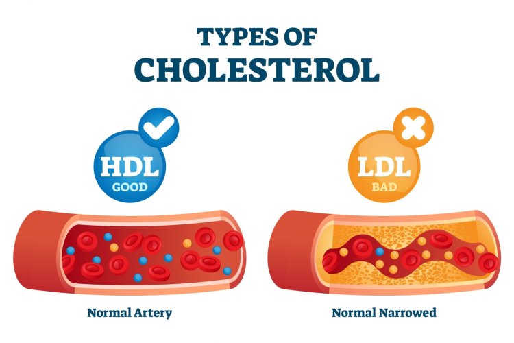 కొలెస్ట్రాల్‌లో LDL, HDL, ట్రైగ్లిజరైడ్స్ అంటే ఏంటి..? ఏది మంచిది..?